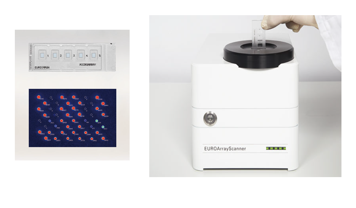 Analizor Microarray  - EUROArrayScanner