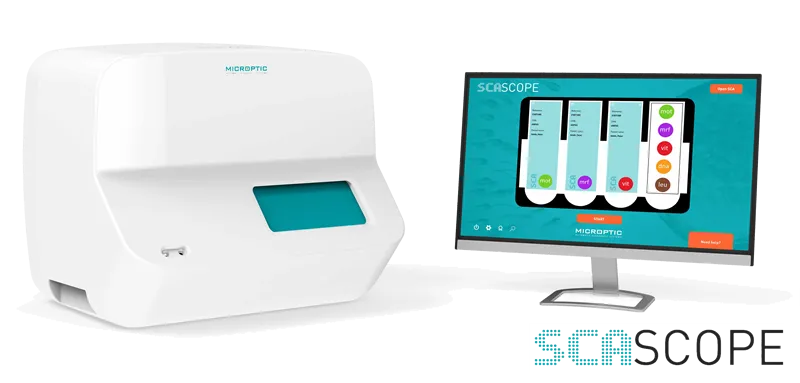 Sistem de analiza automata a lichidului seminal SCA SCOPE 